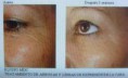 /album/radiofrecuencia-facial-y-corporal/radiofrecuencia-jpg/